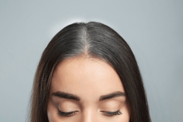 The Thyroid-Hair Connection: What Your Blood Test Reveals