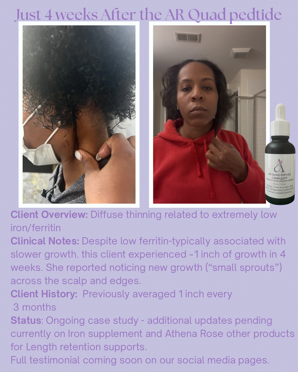 AR Quad Peptide Complex™ Density & Hair Growth Serum -1oz