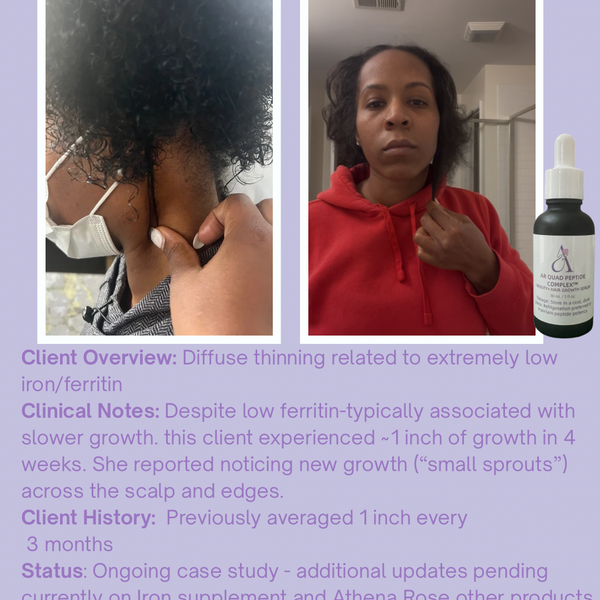 AR Quad Peptide Complex™ Density & Hair Growth Serum -1oz