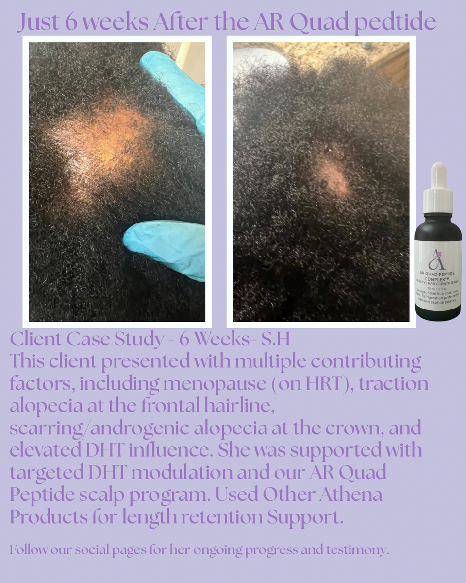 AR Quad Peptide Complex™ Density & Hair Growth Serum -1oz