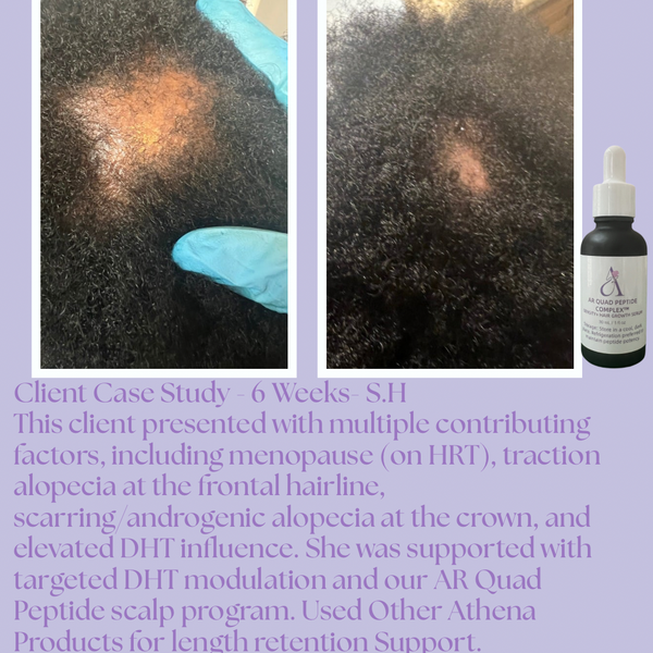 AR Quad Peptide Complex™ Density & Hair Growth Serum -1oz