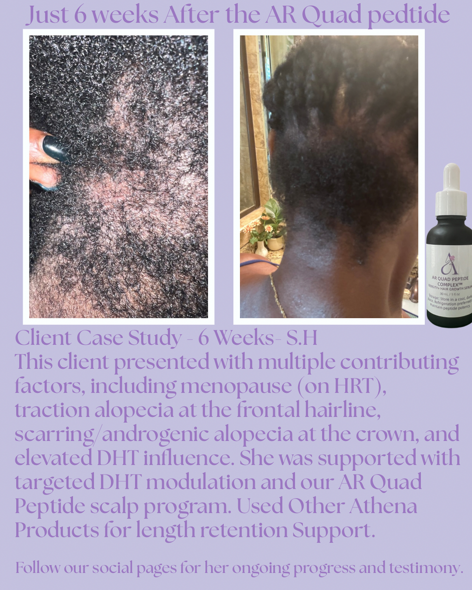 AR Quad Peptide Complex™ Density & Hair Growth Serum -1oz