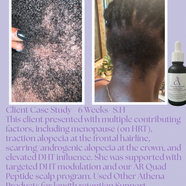 AR Quad Peptide Complex™ Density & Hair Growth Serum -1oz