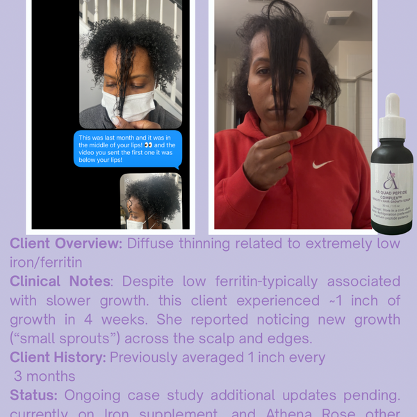 AR Quad Peptide Complex™ Density & Hair Growth Serum -1oz