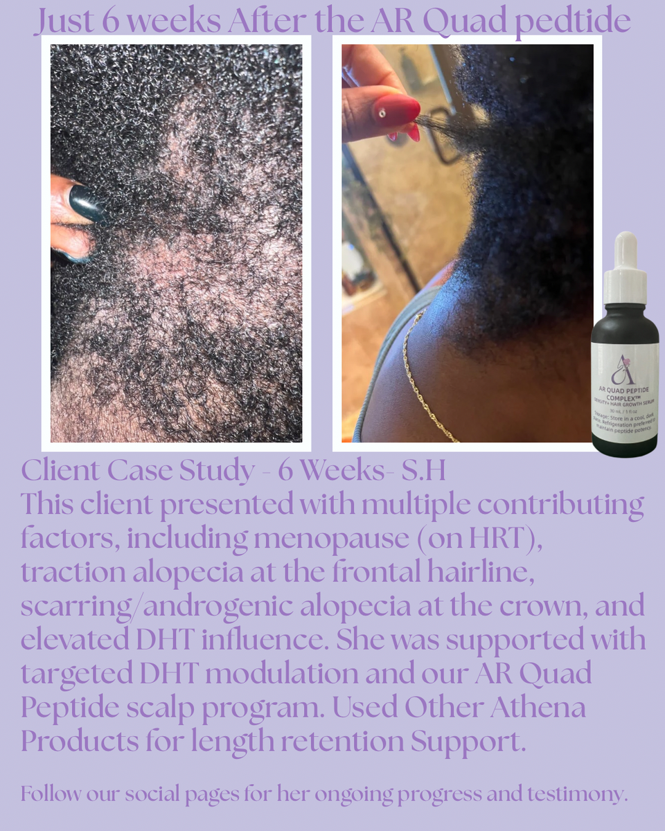 AR Quad Peptide Complex™ Density & Hair Growth Serum -1oz