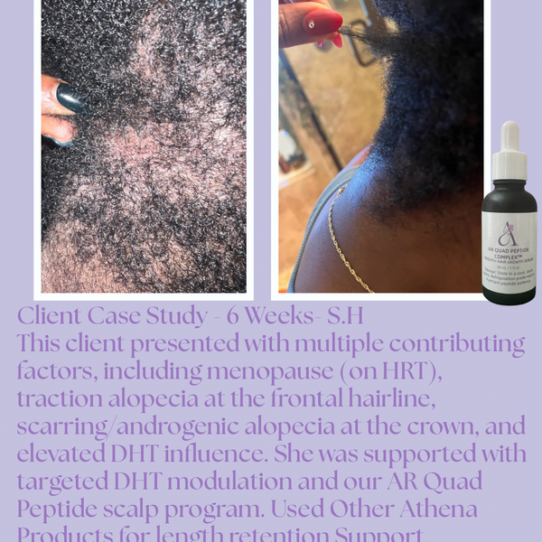 AR Quad Peptide Complex™ Density & Hair Growth Serum -1oz