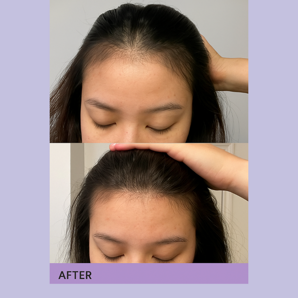 TrichoStrength Growth  Serum. 