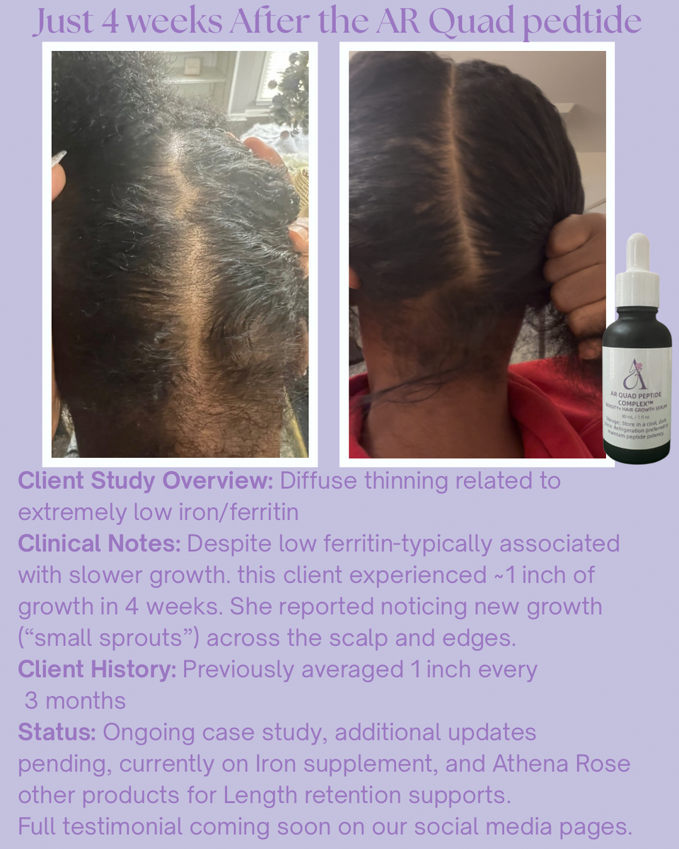 AR Quad Peptide Complex™ Density & Hair Growth Serum -1oz