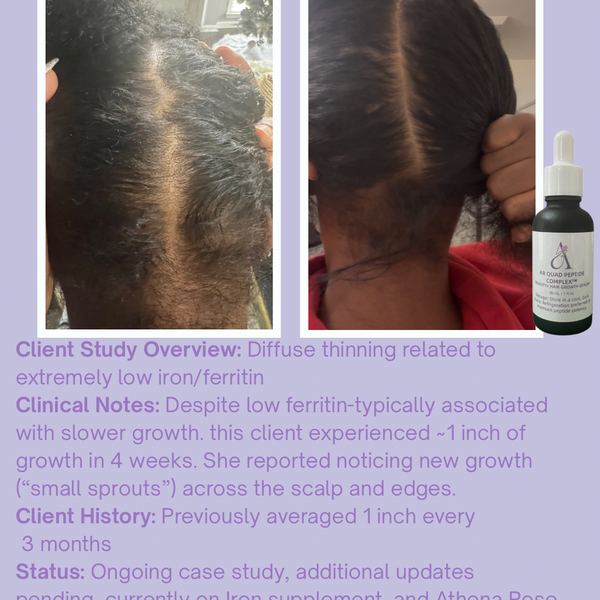 AR Quad Peptide Complex™ Density & Hair Growth Serum -1oz