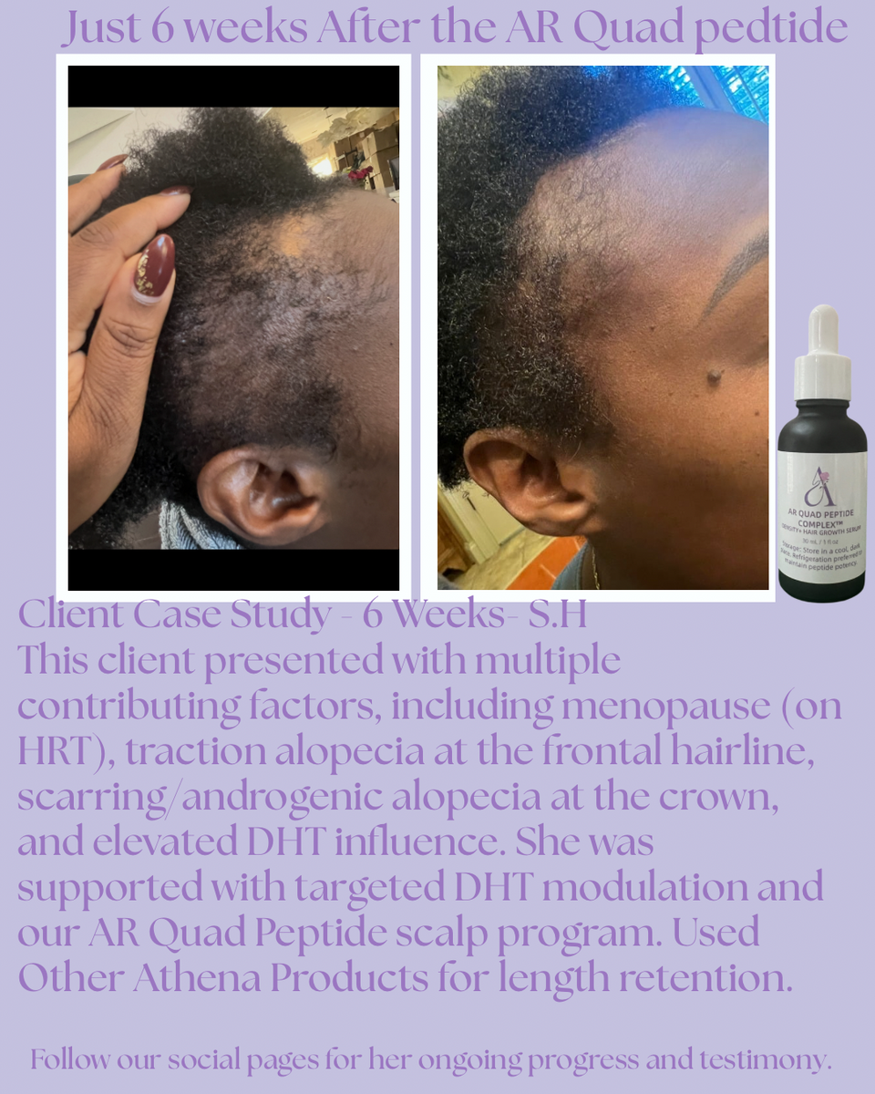 AR Quad Peptide Complex™ Density & Hair Growth Serum -1oz