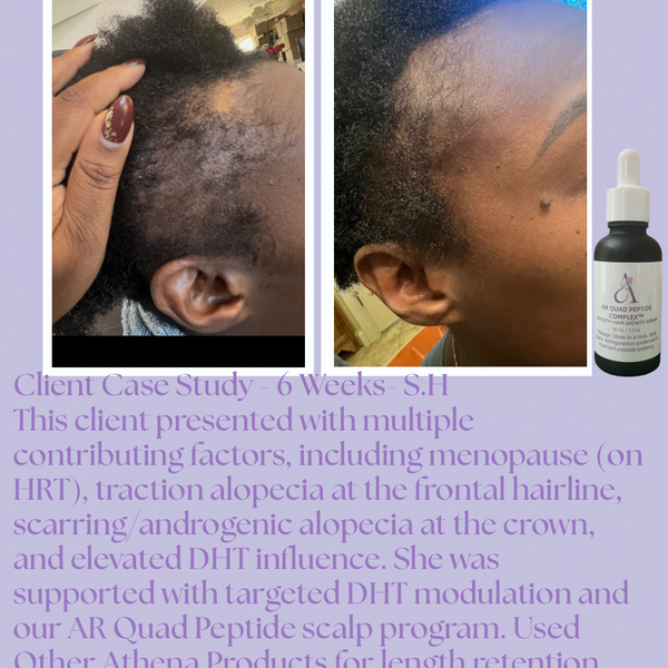 AR Quad Peptide Complex™ Density & Hair Growth Serum -1oz